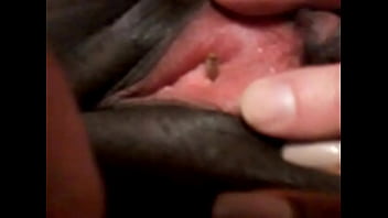 Maggot entering black woman's urethra!
