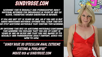 Sindy Rose XO speculum anal extreme fisting & prolapse